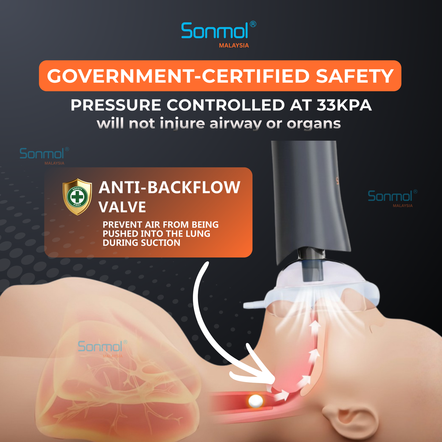 Sonmol Anti-Choking Device (Slim)