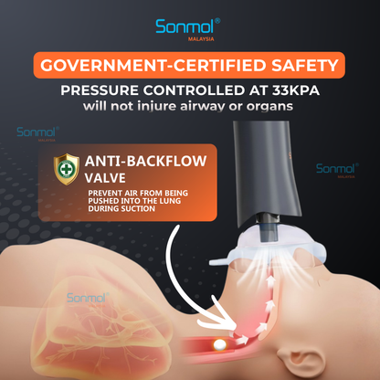Sonmol Anti-Choking Device (Slim)