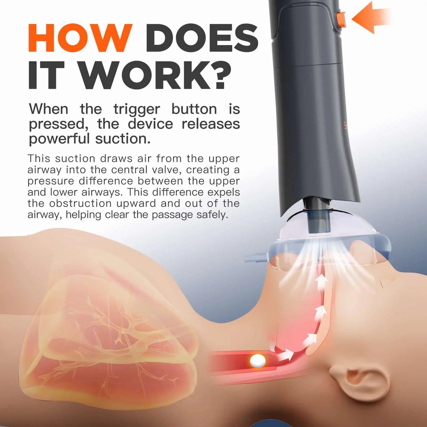 Sonmol Anti-Choking Device Portable My Store